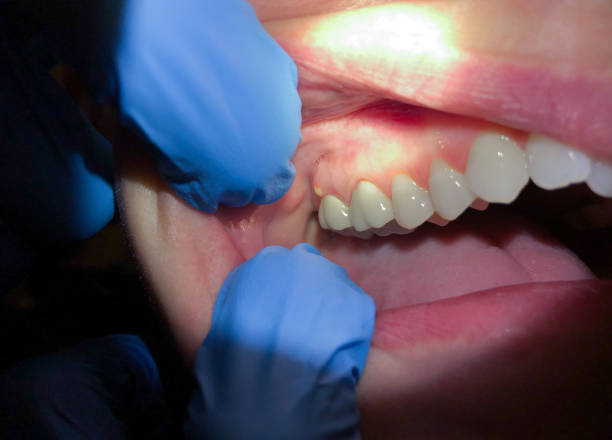 Best Emergency Gum Pain Relief  in Inglewood, CA